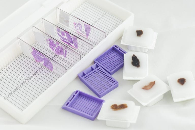 ffpe-tissue-samples-for-research-purchase-ffpe-blocks-human-ffpe