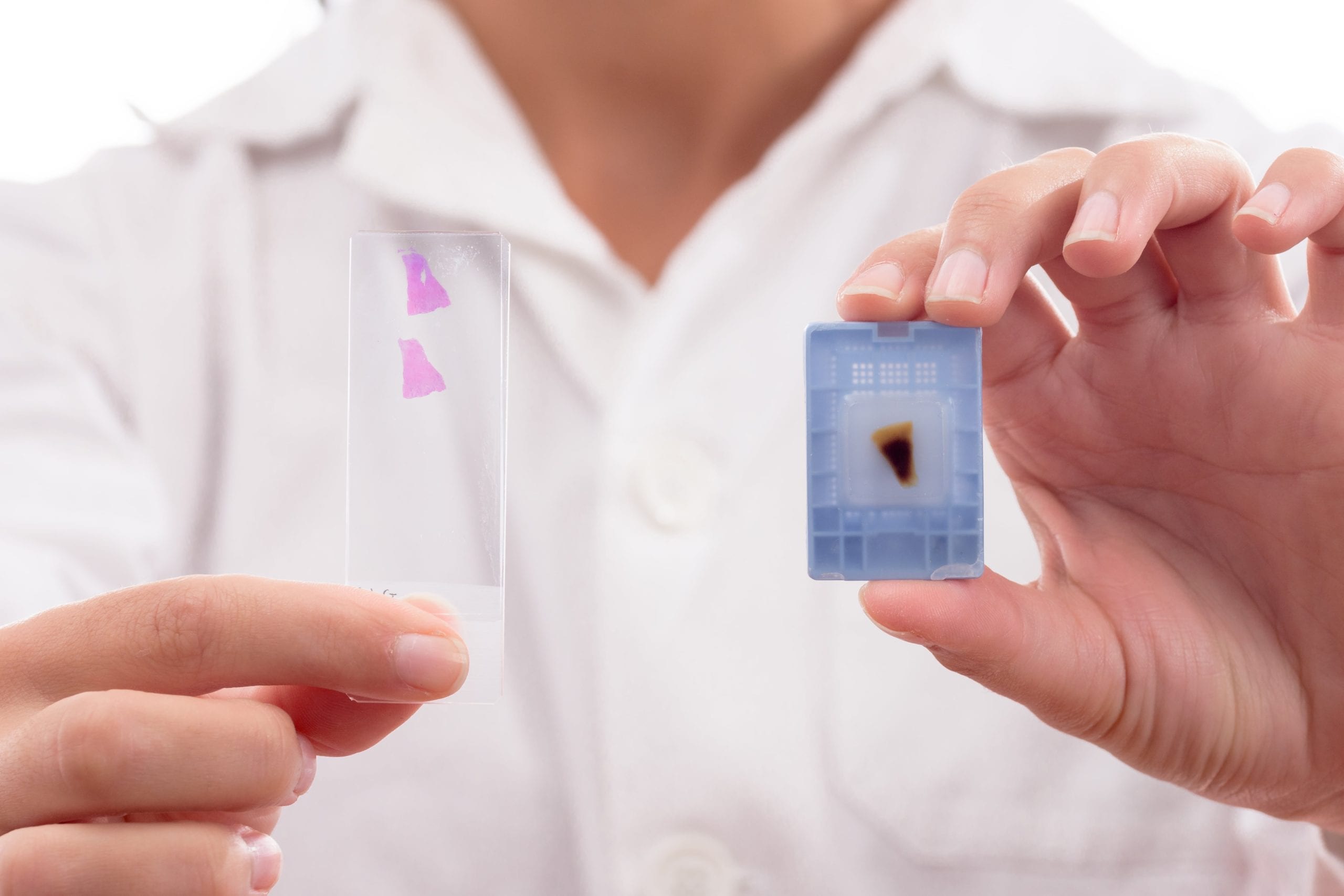 FFPE tissue block and H&E stained slide