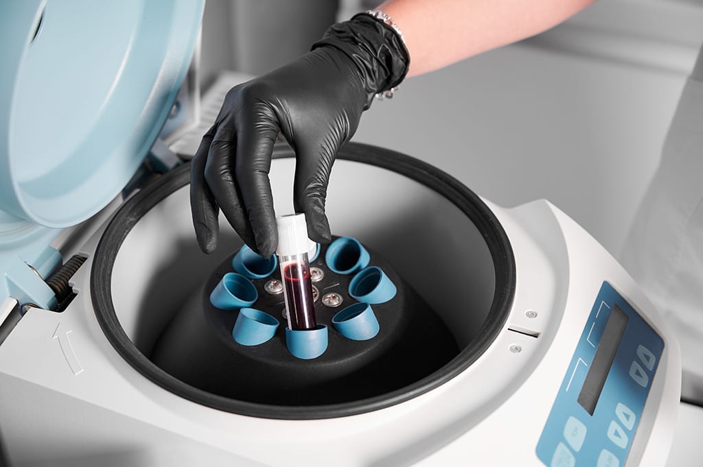 Centrifuging blood samples
