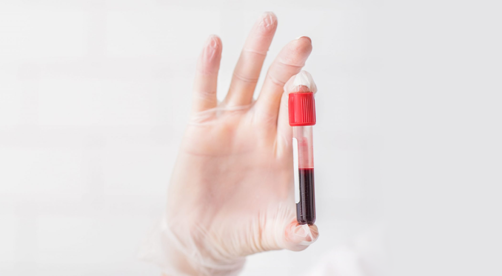 Listing of the top 5 good practices in hadling blood samples.