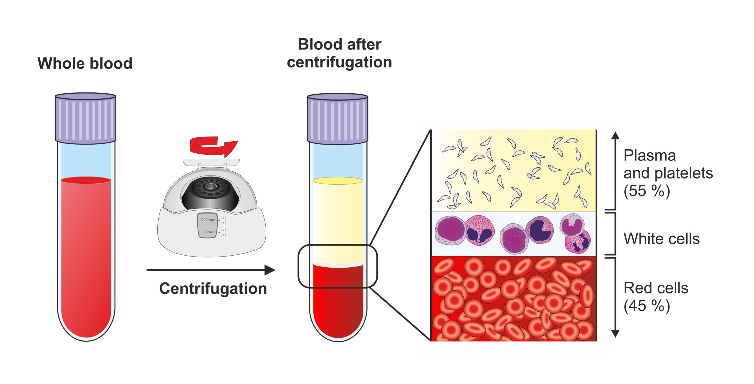 Density gradient separation of whole blood is a key technique to study the diverse blood components.