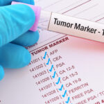 How Biomarker Discovery and Validation Supports Targeted Cancer Therapies