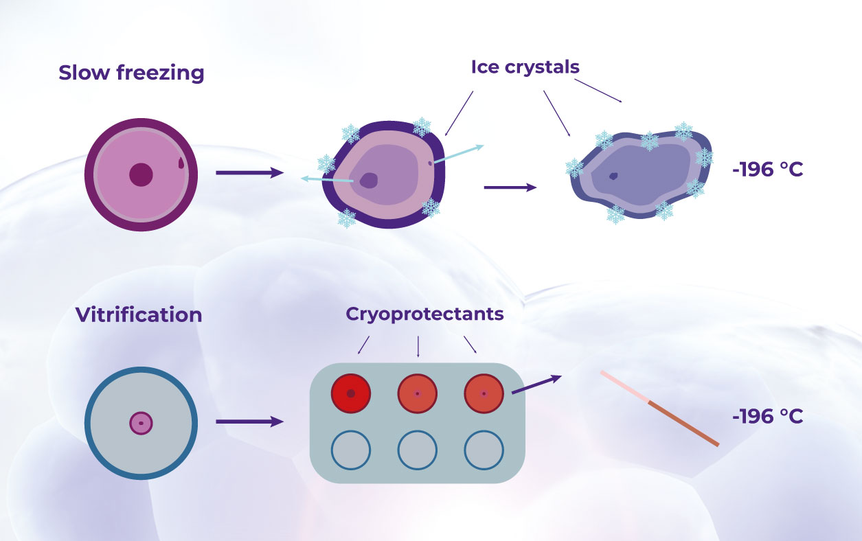 Representation of traditional slow freezing versus newer vitrification cryopreservation techniques.